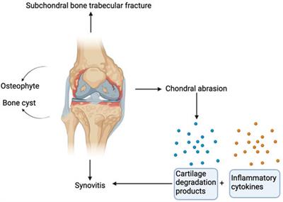 The role of oxidative stress in the development of knee osteoarthritis: A comprehensive research review